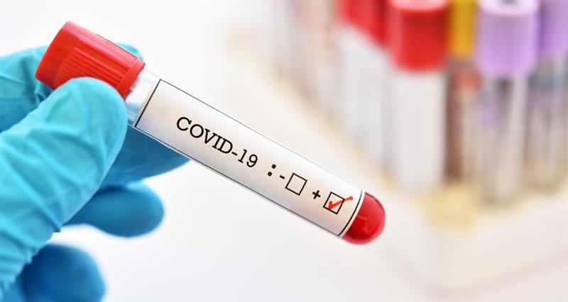 تسجيل 255 إصابة جديدة بفيروس كورونا