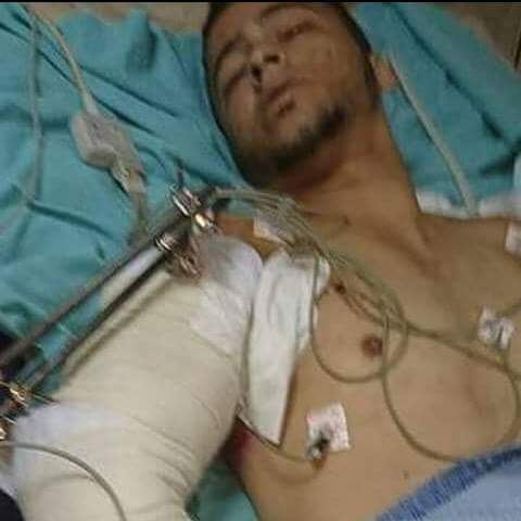 جنين : الاحتلال يعتقل جريحا من مخيم الفارعة جنوب جنين