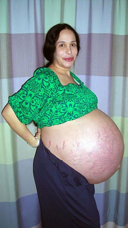 صور| هل تذكرون هذه الأم وتوائمها الثمانية؟.. هكذا أصبحوا اليوم