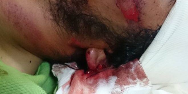 مستوطنون يعتدون على شاب ووالدته