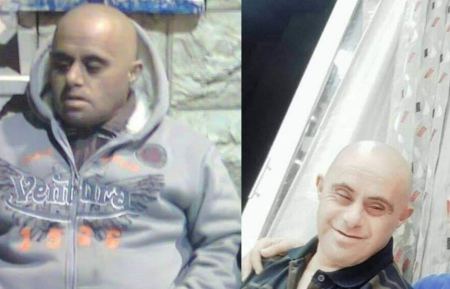  الخليل:مصرع شاب من ذوي الإحتياجات الخاصة بحادث دهس والسائق يلوذ بالفرار