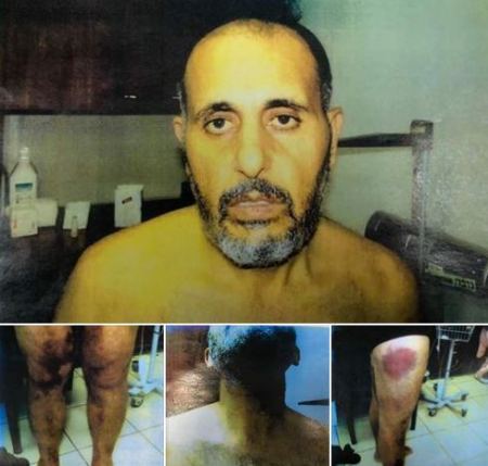 حمدونة:صور الأسير"حناتشة"المهربة اختصرت الكلمات في وصف وحشية الاحتلال