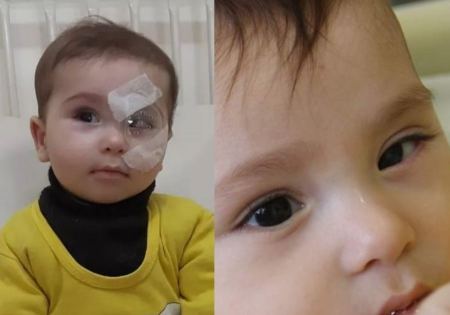 طبيب فلسطيني يعيد البصر لرضيع من غزة