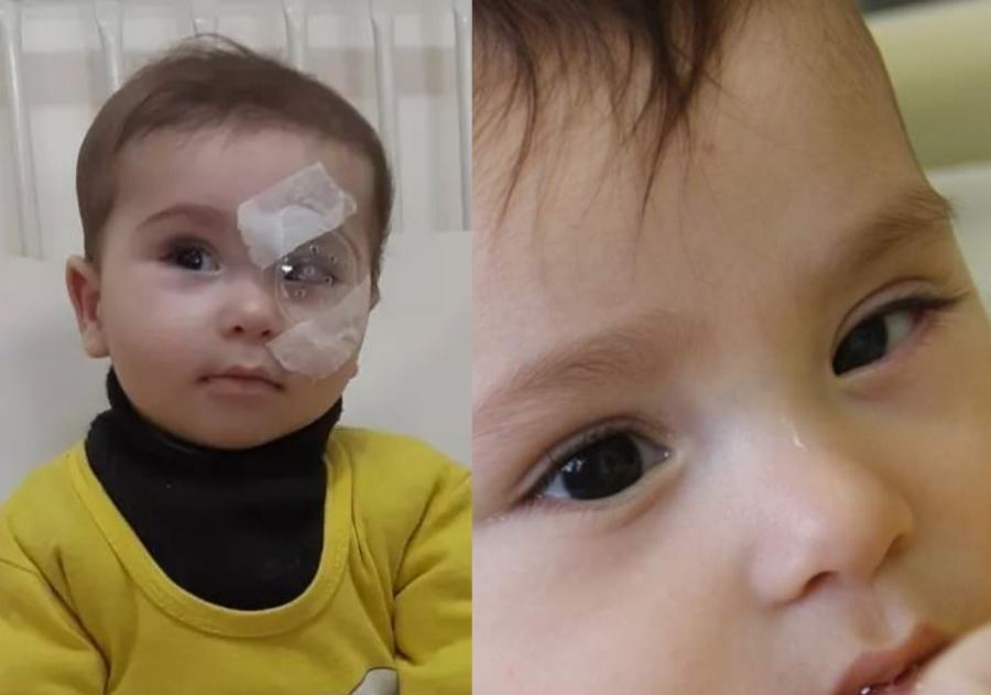 طبيب فلسطيني يعيد البصر لرضيع من غزة