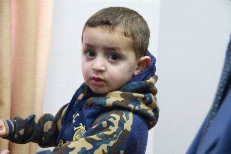  الطفل قاسم يصل رام الله والأطباء سيتابعونه لسنوات، ما هي قصته ! 