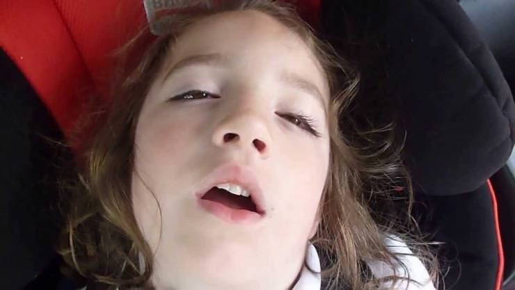 لماذا ينام بعض الأشخاص بأعين نصف مفتوحة،الاسباب خطيرة جدا