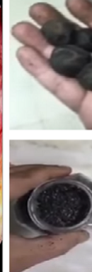 'مريض' بالقولون أهدر 60 ألفًا على الأدوية وشفي بريال واحد فقط!