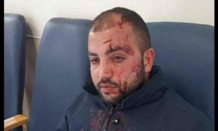 إصابة سائق حافلة مقدسي بجروح جراء اعتداء جديد للمستوطنين