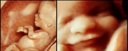 أمور مذهلة لن تتخيلها يشعر بها الجنين في بطن أمه