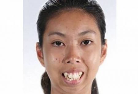 صورة/ عملية تجميل واحده في وجهها غيرت شكلها بالكامل 
