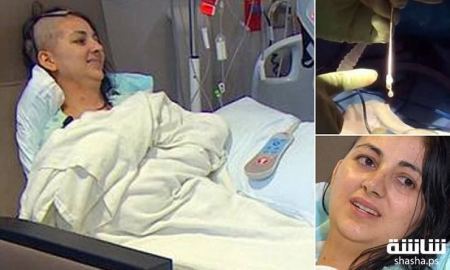 عانت من الصداع النصفي لـ9 أشهر.. إلى أن أخرجوا هذا الشيء من رأسها!