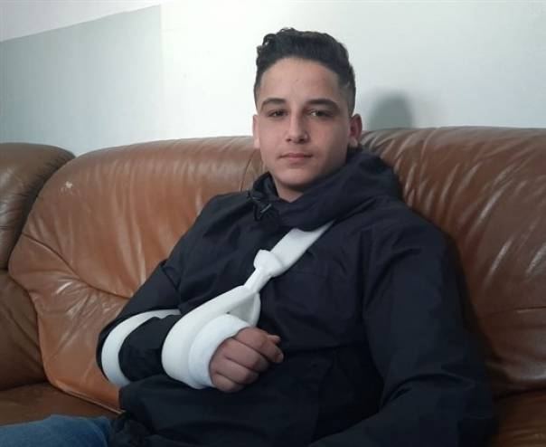 إصابة الطالب محمد عطية برصاص الاحتلال في العيسوية