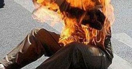 إصابة شاب بحروق حرجة بعد محاولته الانتحار