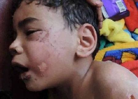 أحرق طفل زوجته ونزع أظافره.. لكن ليست هذه الصدمة!