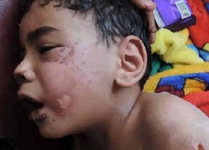 أحرق طفل زوجته ونزع أظافره.. لكن ليست هذه الصدمة!