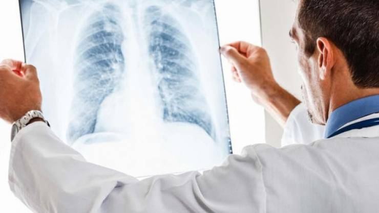 اكتشاف: الرئتان ليستا للتنفس فقط ! 