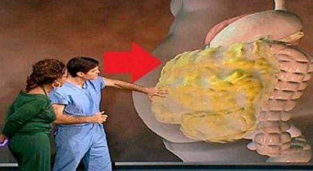 الأطباء ينصحون بهذه الحيلة للتخلص من الوزن الزائد