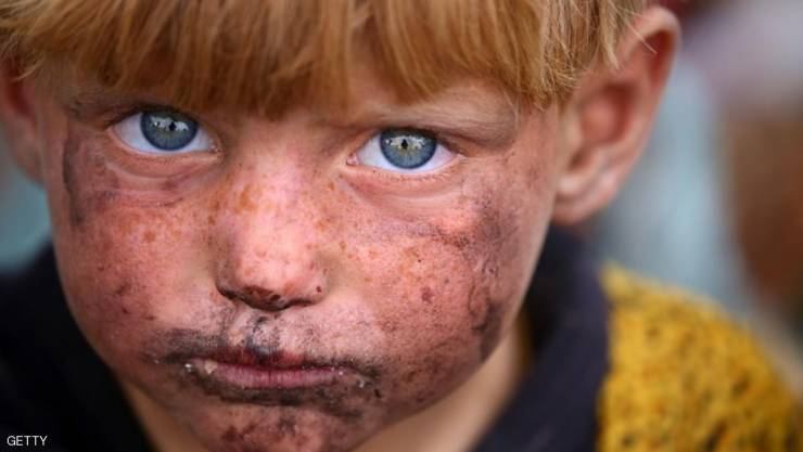 صبي عراقي يروي قصته مع 'وحوش' داعش