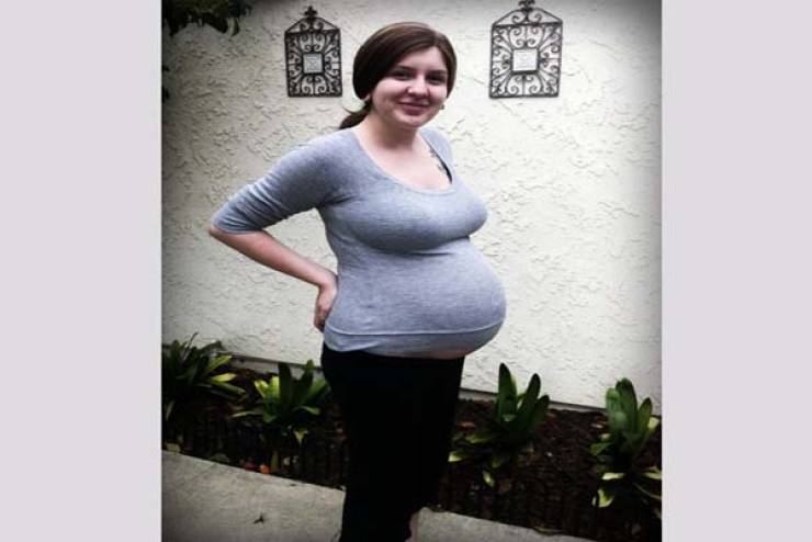 صور/ ضغط الأطباء على بطن الأم فكسروا عظام الجنين..هذا ما حدث بعد 6 أسابيع