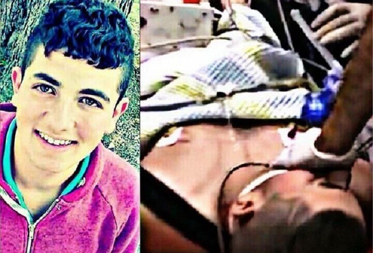 استشهاد طفل من قرية عين سينياً شمال رام الله متأثراً بجروحه