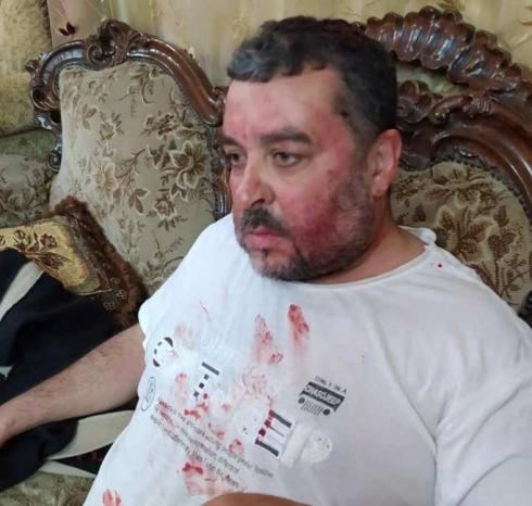  الاحتلال يعتقل شابا من يعبد وينكل بأسرة ويغلق طرقا فرعية