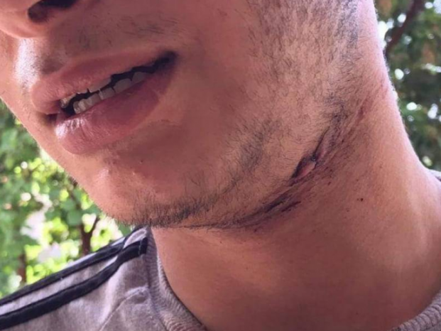 نجا بأعجوبة… محمد يروي قصة الإعتداء عليه من قِبل المستوطن أمس