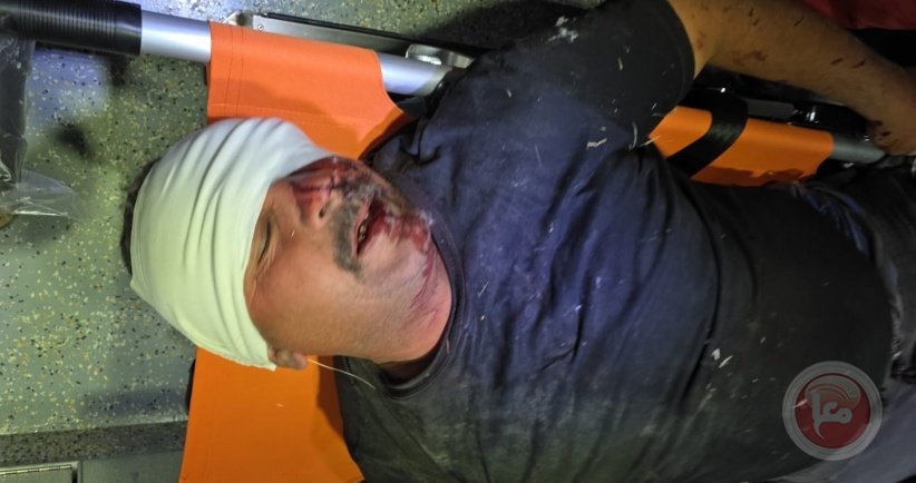 إصابتان في هجوم للمستعمرين على قرية خلة الضبع جنوب الخليل