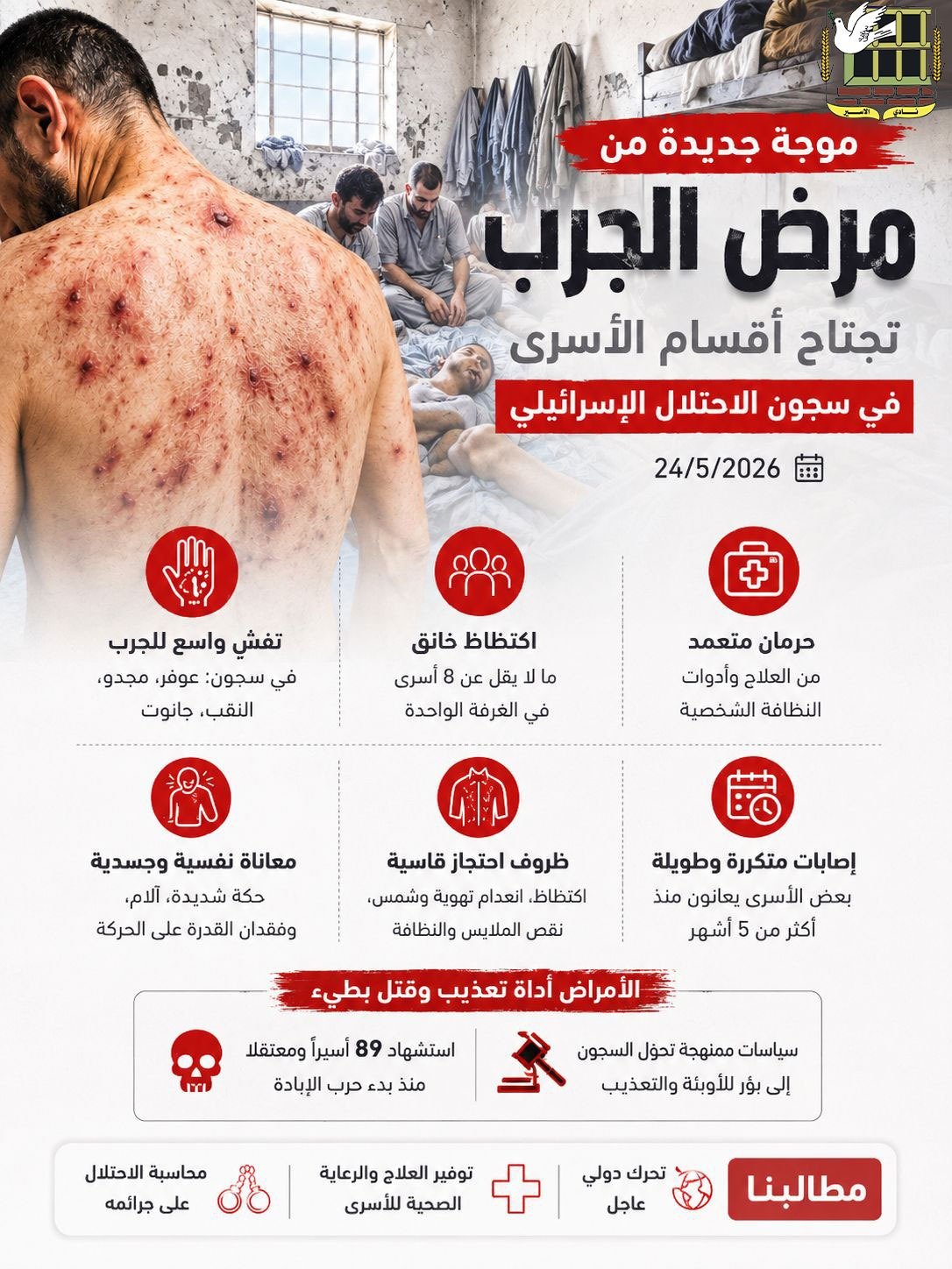 موجة جديدة من مرض الجرب تجتاح أقسام الأسرى في سجون الاحتلال