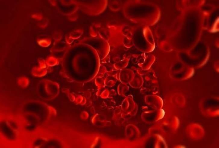 6 حقائق ترتبط بـ'فقر الدم'... تعرّف إليها!