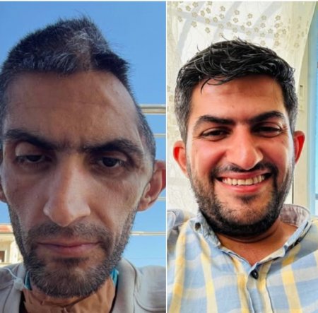 نادي الأسير: صورة الصحفي مجاهد بني مفلح تختزل حقيقة السجن الإبادي الإسرائيلي