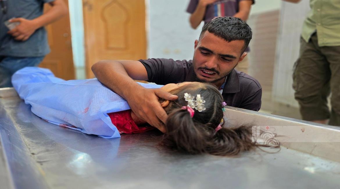 ارتفاع حصيلة الشهداء في قطاع غزة إلى 73,043 والإصابات إلى 173,417 منذ بدء العدوان