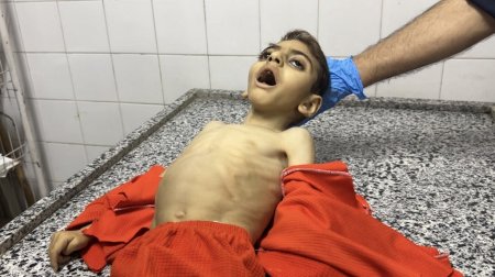 ارتفاع وفيات التجويع إلى 251 بينهم 108 أطفال