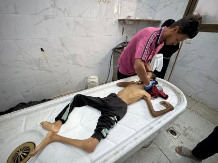 خمس وفيات نتيجة المجاعة في غزة