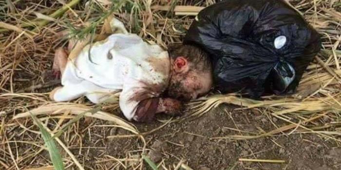 صورة/ العثور على رضيعة مجهولة الهوية قرب مزبلة وقد أكلت القوارض يدها ونهشت جسدها !