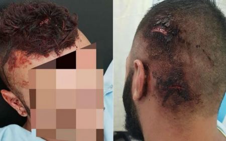 على شاطئ حيفا.. اعتداء يهودي عنيف على 3 شبان لكونهم عربًا
