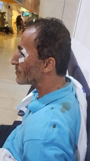 الاحتلال يعتدي على مقدسي بوحشية وهو مقيد