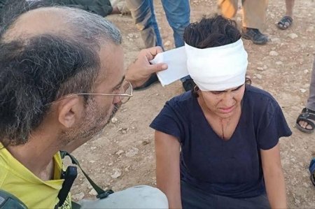 إصابة مواطنين ومتضامنين أجانب في هجوم لمستعمرين على مسافر يطا