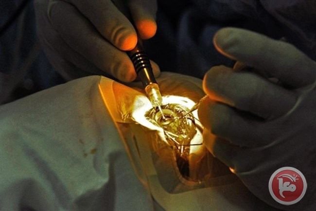 اول عملية جراحية ناجحة داخل العين باستخدام الروبوت