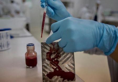 دم الليزر للكشف عن الاورام في الجسم 