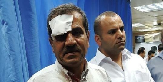 4 اصابات بينها خطيرة بمواجهات جنوب نابلس