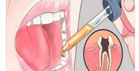 لا حاجة للذهاب إلى طبيب الأسنان ضعوا هذا على الضرس الموجوع