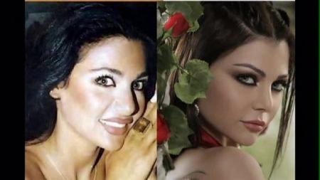 شاهد ماذا فعلت عمليات التجميل ب فنانات اصبحوا معشوقات الملايين لجمالهم الحالي 