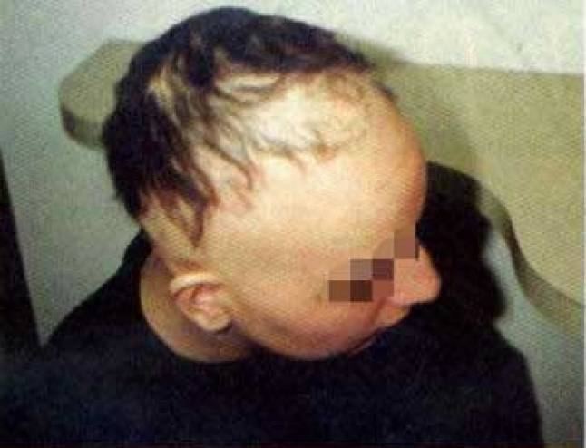 هذه العادة التي تفعلها جميع الفتيات جعلتها تفقد شعرها.. احذروها