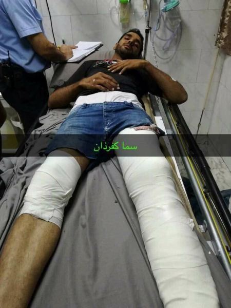 إصابة 6 عمال من بلدة كفرذان غرب جنين نتيجة سقوطهم من علو