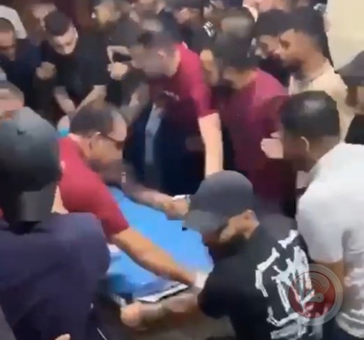 اصابات بينها خطيرة خلال انفجار مركبة داخل مخيم الفارعة جنوب طوباس