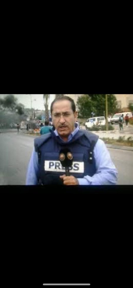 الاحتلال يعتدي على الصحفي أحمد زكي والدكتور نضال العارضه في جنين