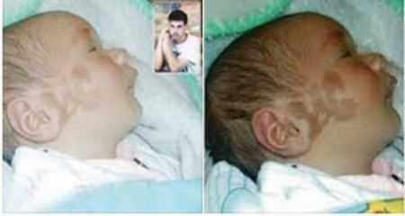 طفل وُلد مكتوباً على خده اسم علاء.. فمن هو علاء ؟ 