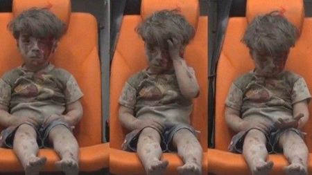 هل صورة الطفل عمر التي حازت على تعاطف العالم 'مفبركه' ... تابع