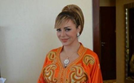 سوزان نجم الدين بعد التجميل .. صورة