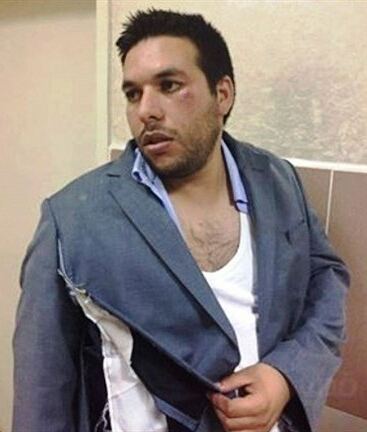 3 إصابات خلال الاعتداء على مسيرة في رام الله